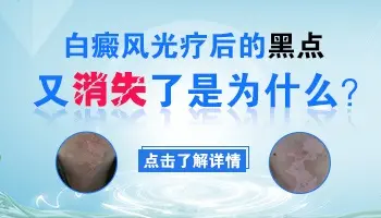 白癜风长出黑点几天又没了是什么原因