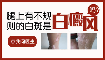 男性大腿很多白斑图片