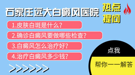 白癜风早期的症状图片