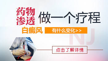 白癜风四年了没有多大变化怎么治