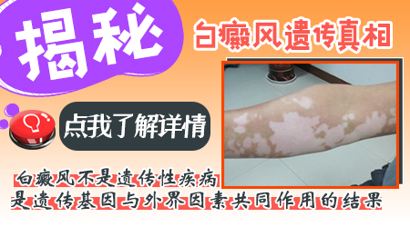 白癜风遗传的案例 如何降低遗传几率