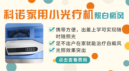 科诺308治白癜风是不是骗人的