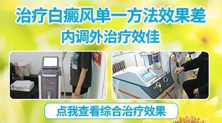 早期白斑用JAK抑制剂乳膏效果好不好