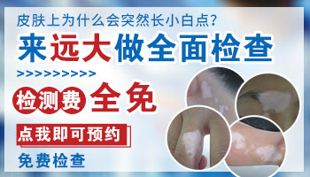 白斑是白癜风吗 白癜风医院检查白斑费用全免