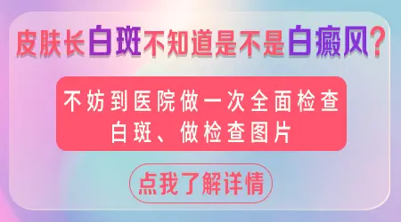 身上长芝麻大的白斑一定是白癜风吗