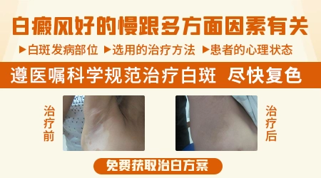 为什么脸上的白斑好得快手脚上的好得慢