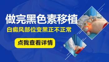 白癜风小面积种植手术疼不疼