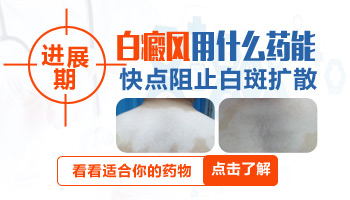 手指末端的白癜风扩散的快吗