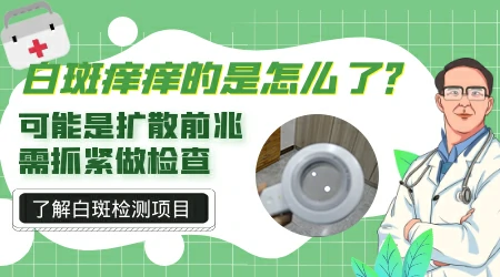 白癜风扩散时会有瘙痒感吗