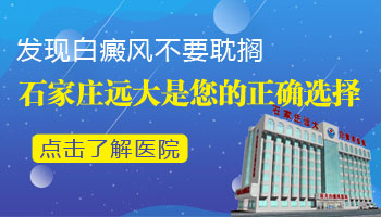 生殖器周围的白癜风容易治疗吗