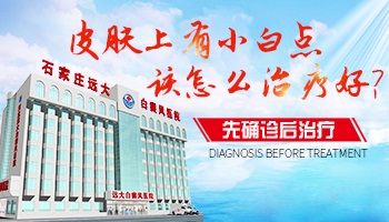 身上出现的白点点如何治疗才能好