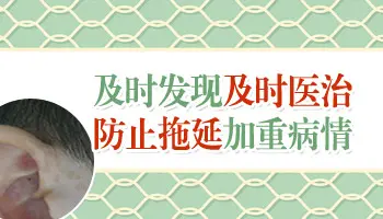 刚长白斑平时能正常化妆遮盖吗
