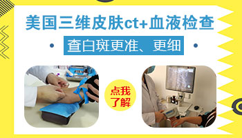 皮肤长白斑一般需要什么检查