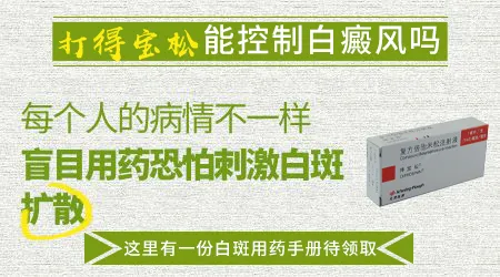 白癜风打得宝松效果怎么样
