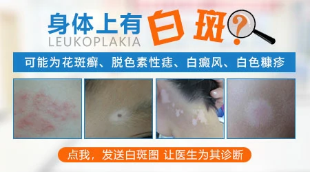 脸上突然出现一块很浅的白是什么原因