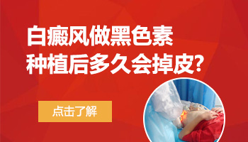 白癜风做黑色素种植的皮会不会掉
