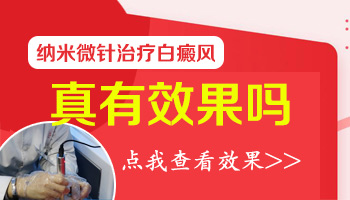 纳米微针治疗白癜风疼不