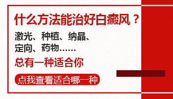 河北专业治疗白斑 治疗白斑常用方法