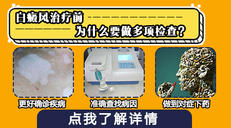 白癜风化验血和正常人的血一样吗