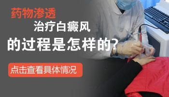 白癜风照光用什么遮正常皮肤