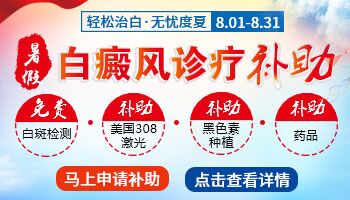 儿童白癜风检查一般医院都能做吗