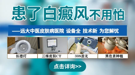 有没有什么偏方可以快速治好白癜风