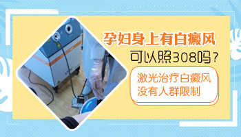 白癜风患者怀孕了可以照灯吗