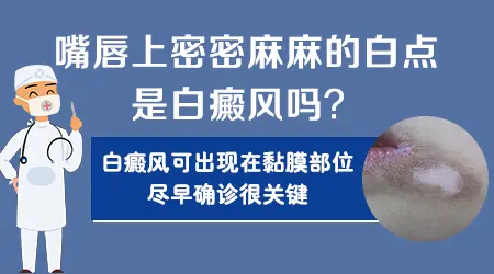 嘴角旁突然出现一块白斑的东西是什么