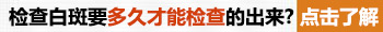 白斑是不是白癜风都做什么检查项目