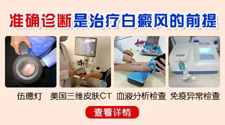 白癜风图片鉴别与区分 贫血痣和白癜风怎么看图分