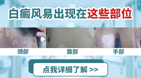 宝宝脖子褶皱处发白是不是得了白癜风
