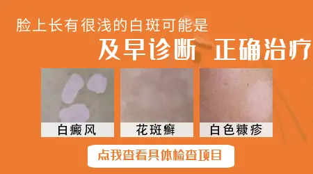脸上长了一块边界模糊的白块是什么问题