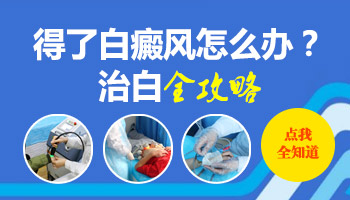 男性大腿根上长白癜风怎么治疗好