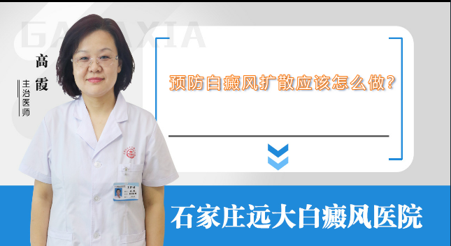 预防白癜风扩散应该怎么做