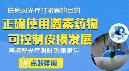 白癜风外用激素药膏ZUI长能用几周