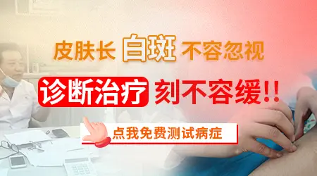 白癜风图片鉴别和初诊 不用跑医院先看图判断
