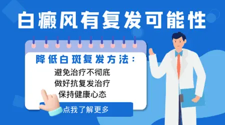白癜风用芦可替尼会不会复发