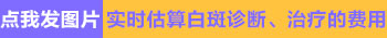 中药治疗白癜风效果好吗 收费高不高