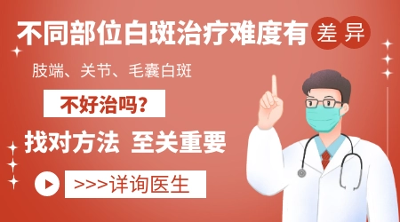 白癜风治疗3个月一点没缩小是不是方法无效