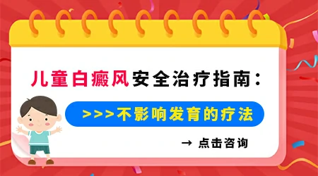 儿童白癜风ZUI佳治疗年龄是几岁