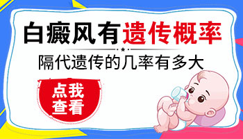 婆婆白癜风遗传给男还是女