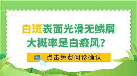 白斑光滑无皮屑会是白癜风吗