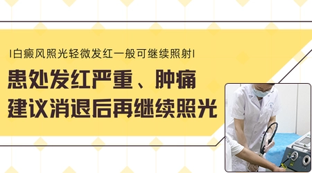白癜风照308激光后发红多久会好