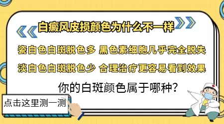 白癜风多长时间会变成乳白色