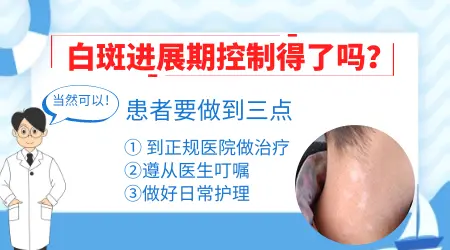 进展期白癜风吃什么药控制白斑扩散