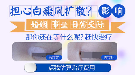 身上到处都是白斑还扩散
