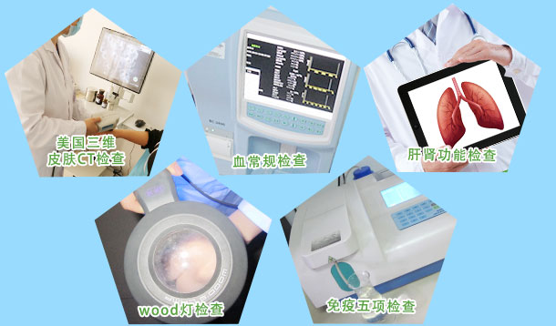 脖子上有白斑不痛不痒怎么回事