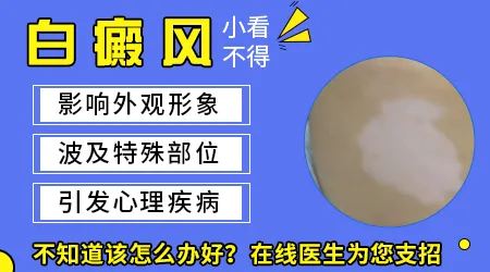 胳膊上无缘无故出现白色点点怎么回事