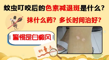 蚊子咬后留下白斑一直不褪怎么回事