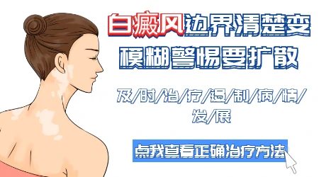 伍德灯下白斑边界模糊是什么意思
